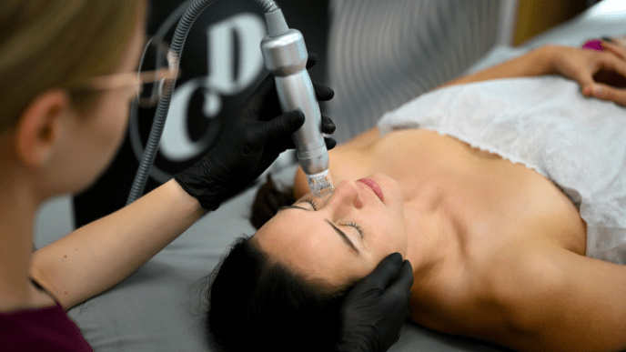 Radiofrekwencja mikroigłowa Scarlet S